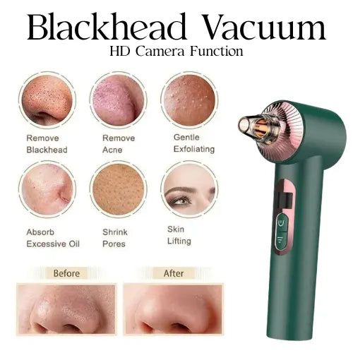 Blackhead Vacuum